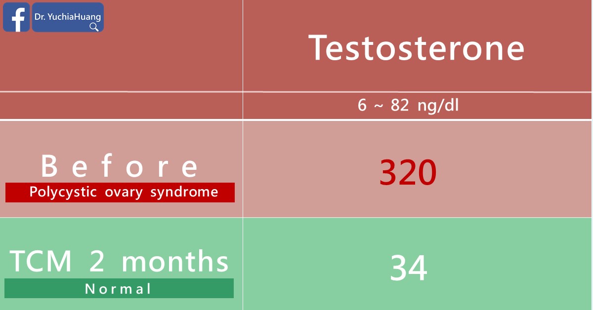Testosterone before treatment (polycystic ovary syndrome, 320) and after 2 months of TCM (normal, 34)