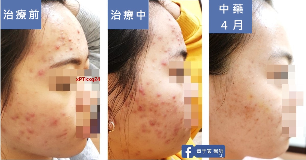用經方全面引爆深埋藏的卡比獸（圖 1）