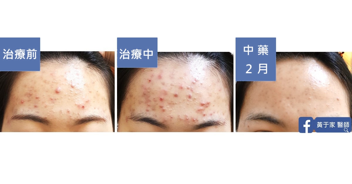 用經方全面引爆深埋藏的卡比獸（圖 2）