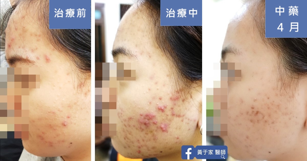 用經方全面引爆深埋藏的卡比獸（圖 3）