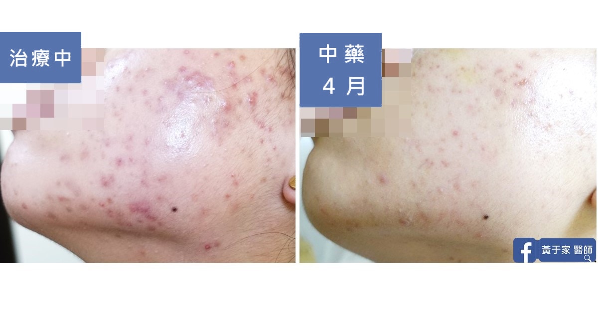用經方全面引爆深埋藏的卡比獸（圖 5）
