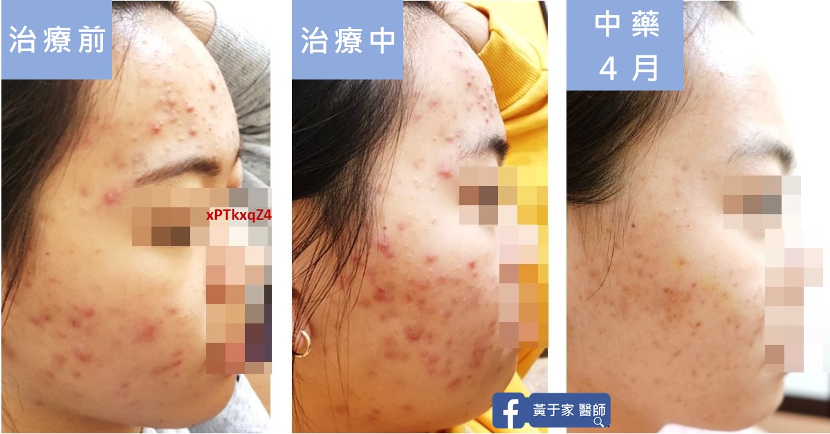 治療過程中病情進展不如預期時的紀錄