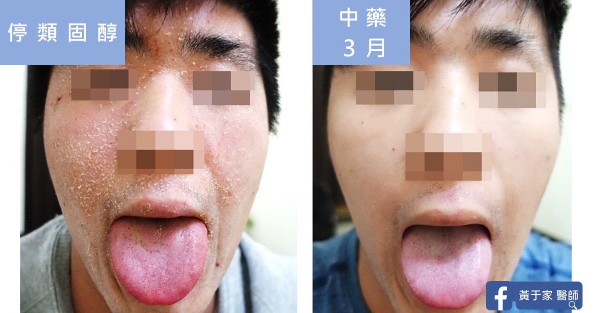 文章標題圖