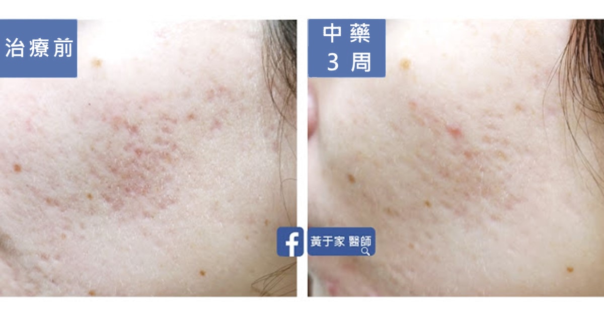 化妝無法改變膚質(圖 1)