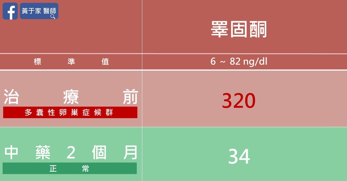 睪固酮超標四倍的多囊性卵巢患者(圖 1)