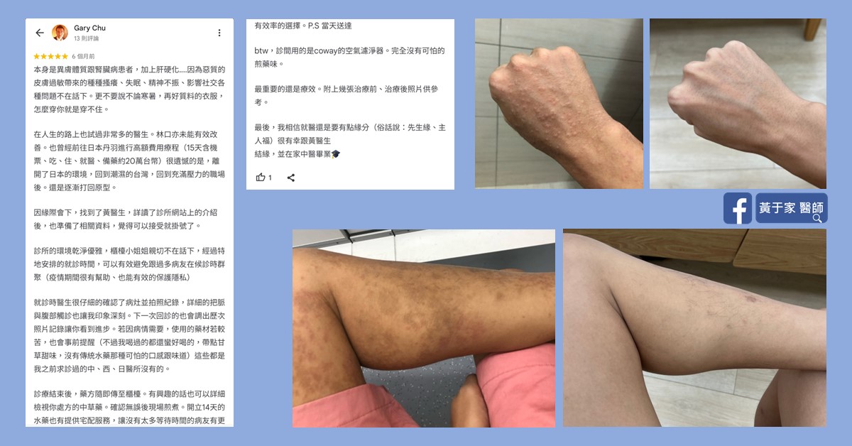 另一位曾接受丹羽療法的患者留下的評論截圖,附手臂與腿部照片