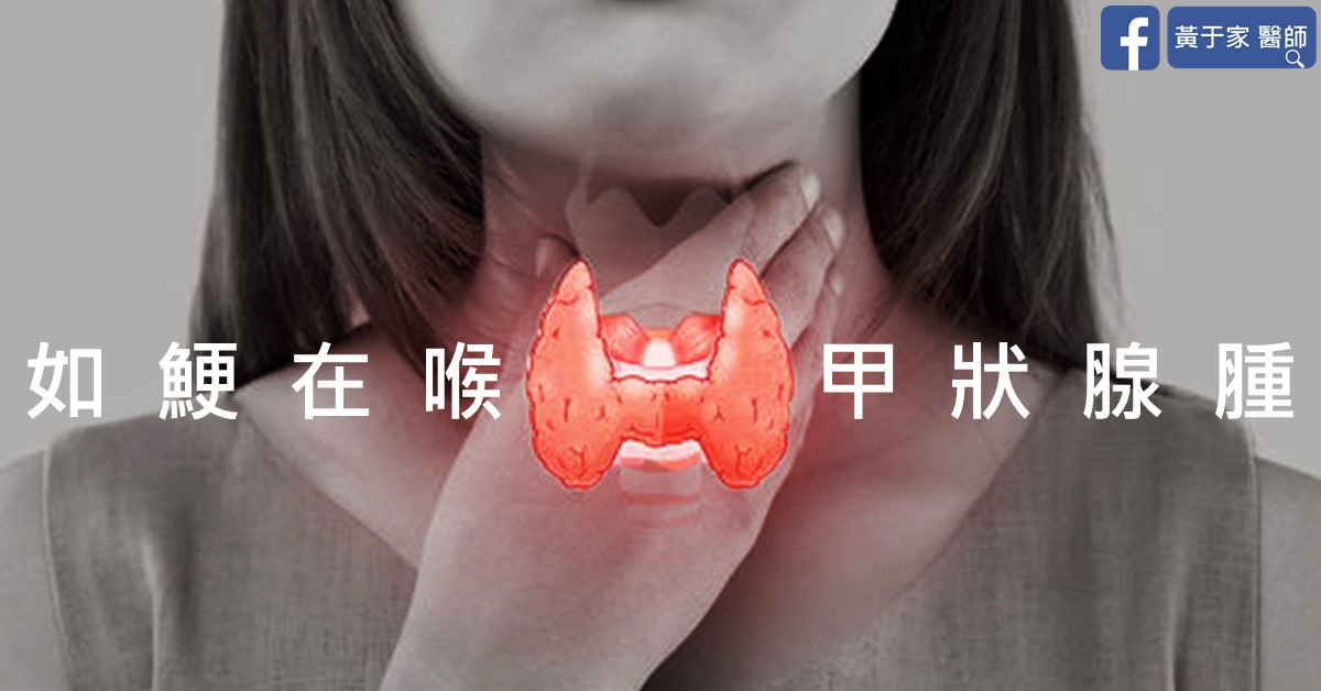 如鯁在喉的 6 公分甲狀腺結節