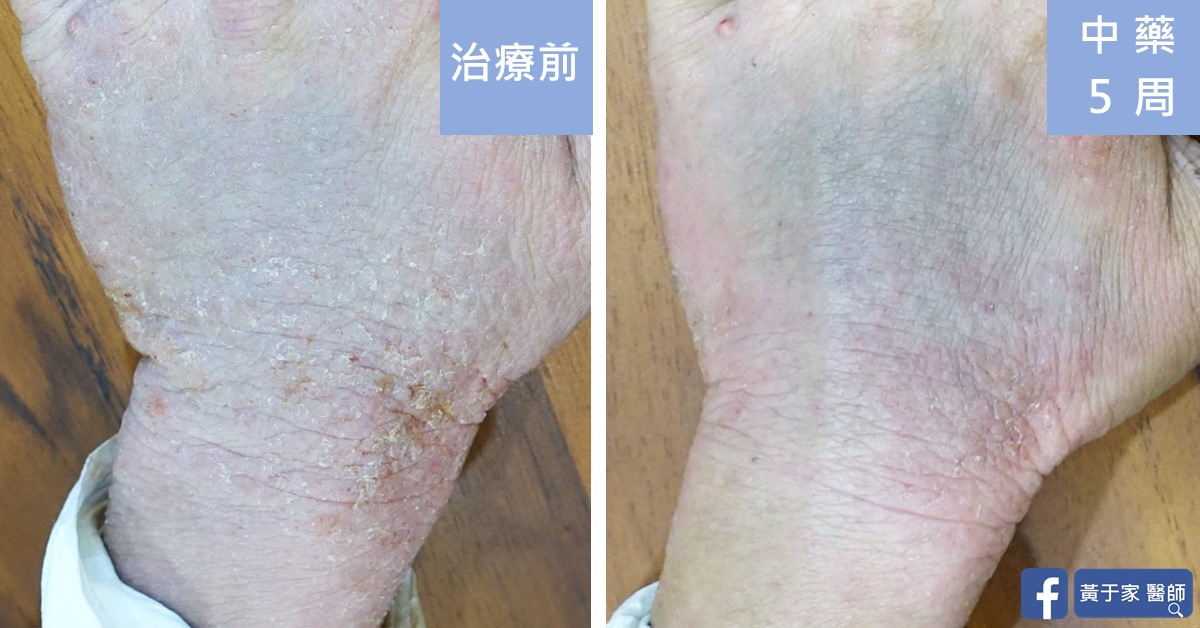 文章標題圖