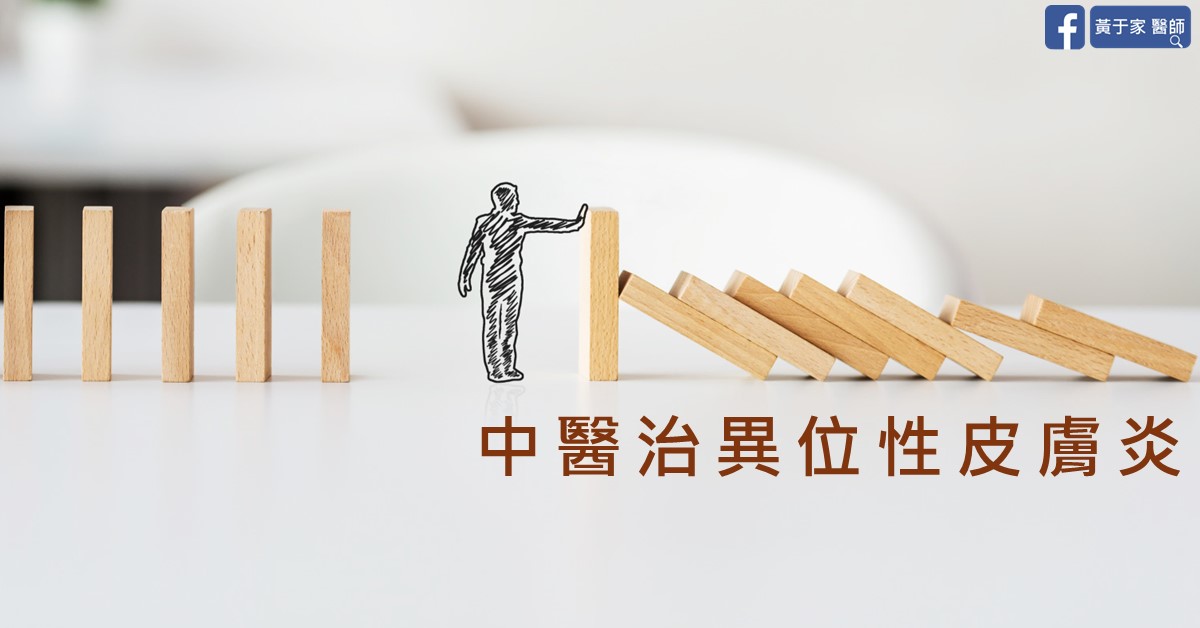 文章標題圖,一個手繪人形擋住即將倒下的骨牌,圖上文字為「中醫治異位性皮膚炎」
