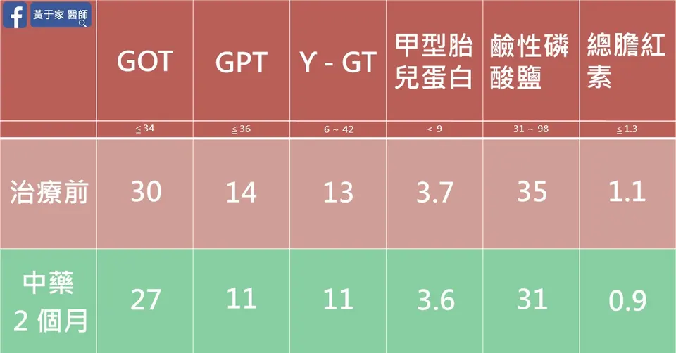 肝硬化 20 年患者中藥 2 個月前後肝功能數據表