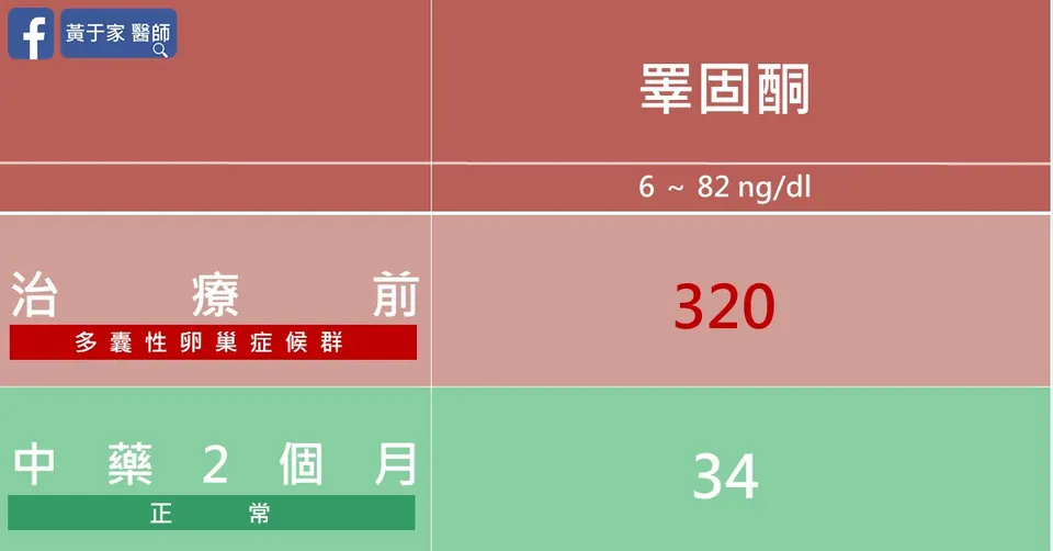 多囊性卵巢症候群患者睪固酮治療前後數值
