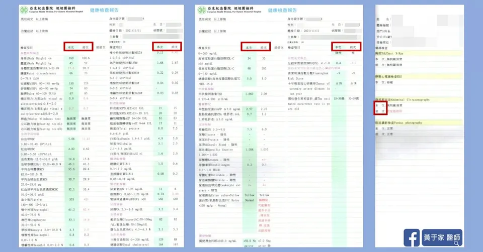 濕疹多年，治療前後皮膚外觀比對（2）