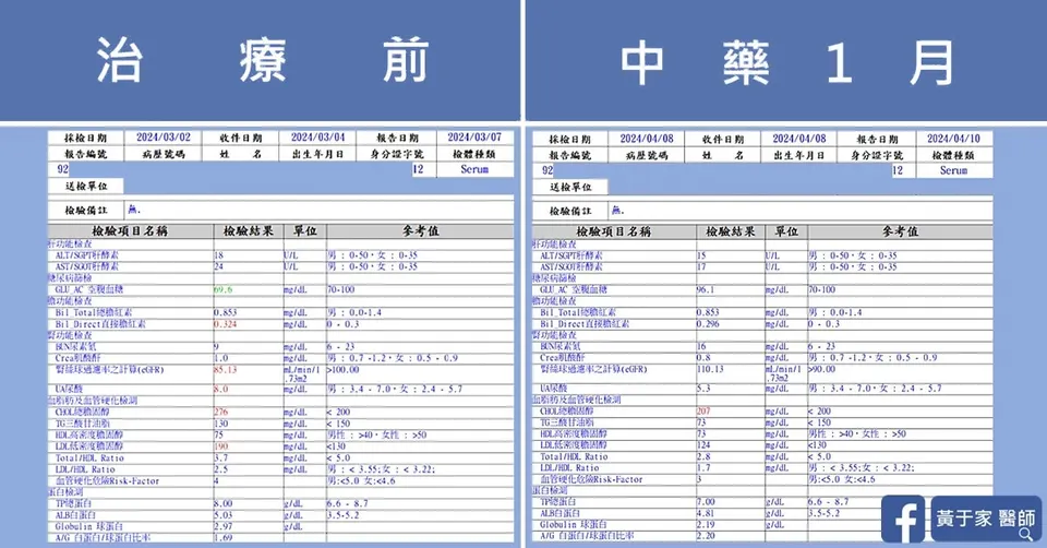 濕疹，治療前後皮膚外觀比對（2）